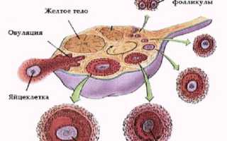 Киста желтого тела