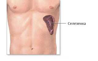 Боль в селезенке