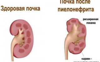 Чистка крови: для чего нужна, обзор способов