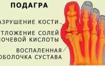 Таблица разрешенных продуктов при подагре