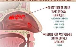 Как остановить кровотечение из носа