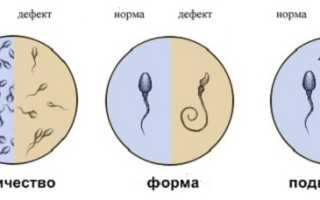Мужское бесплодие
