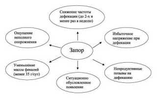 Атонический запор