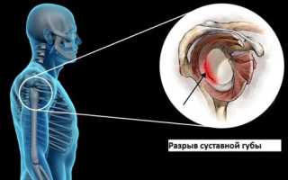 МРТ плечевого сустава