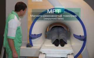 Ангиотрофоневроз