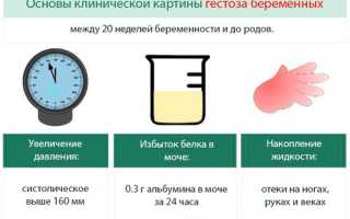 Гестоз при беременности