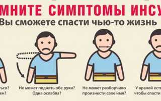 Заторможенность