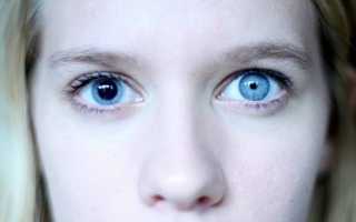 Анизокория