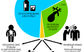 Острый панкреатит