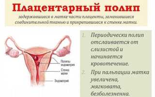 Плацентарный полип