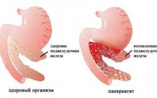 Пульсация в животе