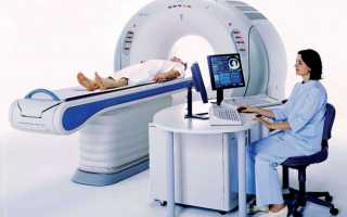 Хорея Гентингтона