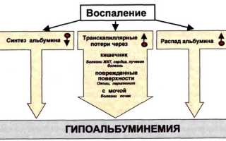 Гипоальбуминемия