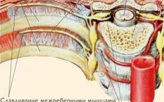 Невралгия грудного отдела позвоночника
