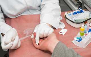 Гипогликемия