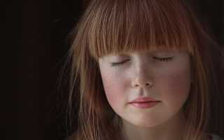 Как избавиться от веснушек в домашних условиях —  самые эффективные  рецепты