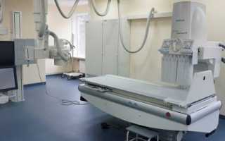 Артрогрипоз