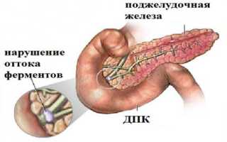 Реактивный панкреатит