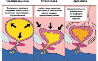 Энурез у детей