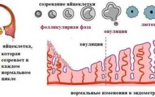 Ановуляция