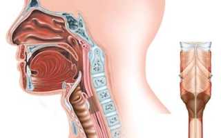 Стеноз гортани