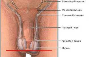 Гипоплазия яичек